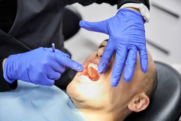 Best Broken or Chipped Tooth Repair in Larkfield Wikiup, CA