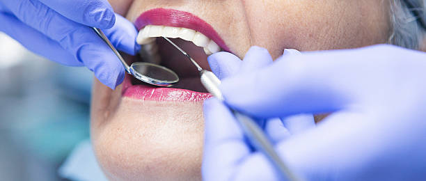 Best Emergency Cosmetic Dentistry (e.g., broken veneers) in Larkfield Wikiup, CA